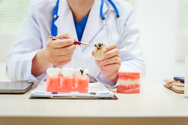 What To Expect During Root Canal Therapy